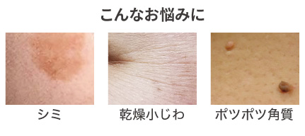 薬用美白］プレミアムリッチエッセンシャルオイル（美容液