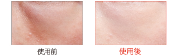 使用前 使用後